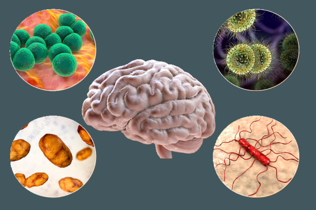 Illustration of meningitis-causing bacteria with labels on brain and spinal cord impact.