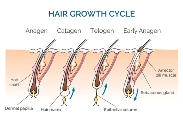 Diagram of the hair growth cycle showing Anagen, Catagen, Telogen, and Early Anagen phases, affected by hormonal imbalances causing hair loss in women.